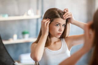 come eliminare la forfora